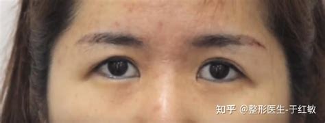 女人眼尾下垂面相|眼角下垂的面相對運勢有什麼影響